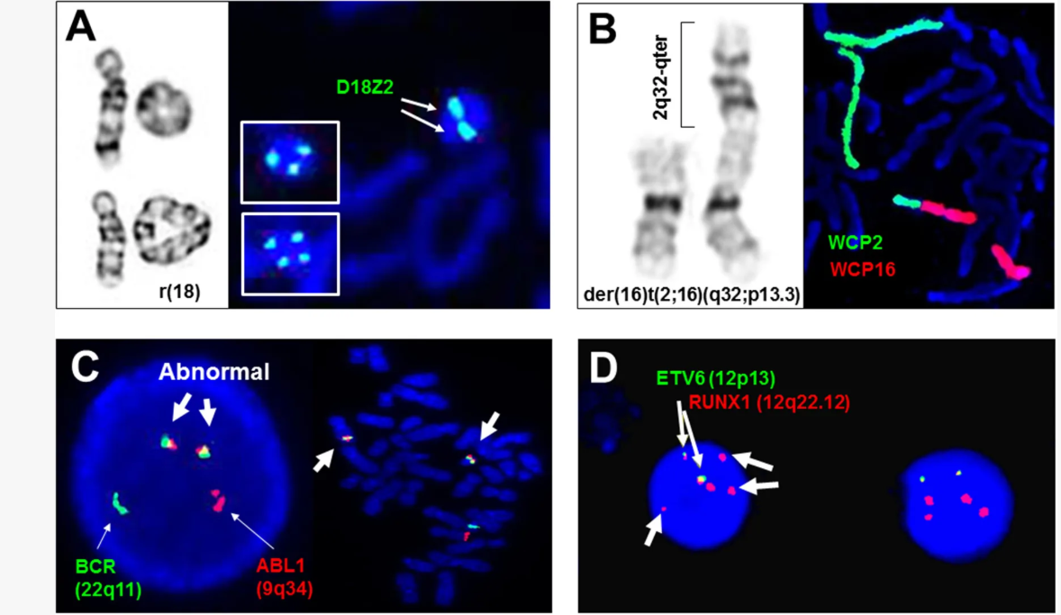 Adjunctive and diagnostic assays of FISH in clinical cytogenetics.
