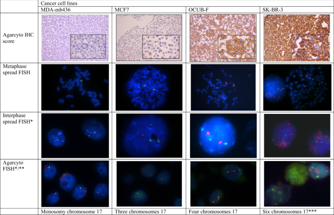 Examples of HER2 IHC of agarcyto slides and HER2/CEP17 FISH results on metaphase spreads, interphase nuclei, and agarcyto slides